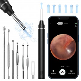 Wifi Otoscope Ear Camera Waterproof Camera Elimination Spoon USB Otoscope Ear Cleaner Ear Wax Removal Tool Suitable  Endoscope For Android,  Iphone Phones And Ipad